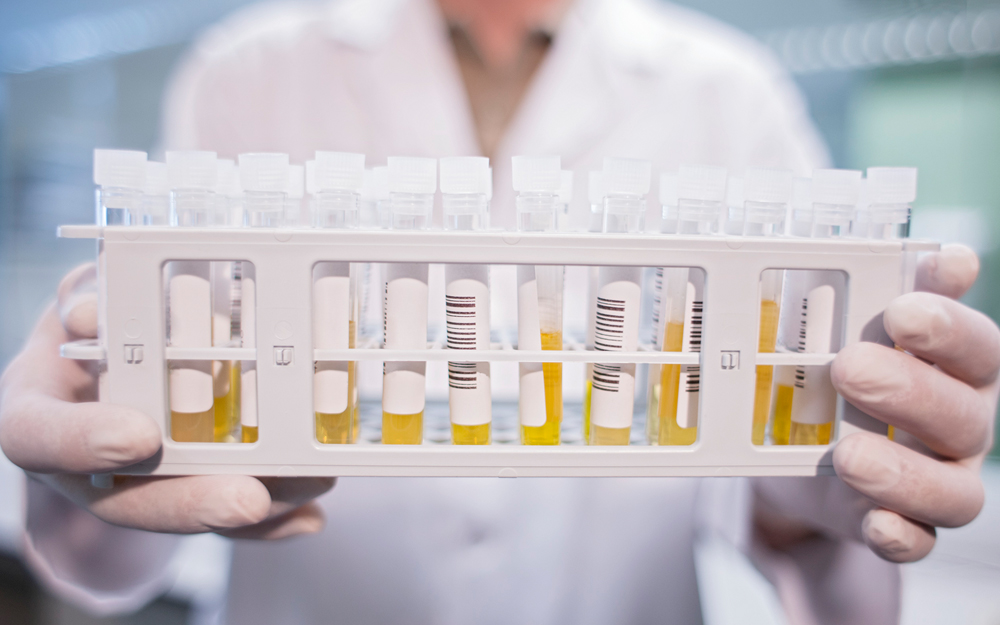 Test tubes containing convalescent plasma.